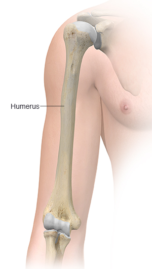 Krames Online - Understanding a Humerus Fracture
