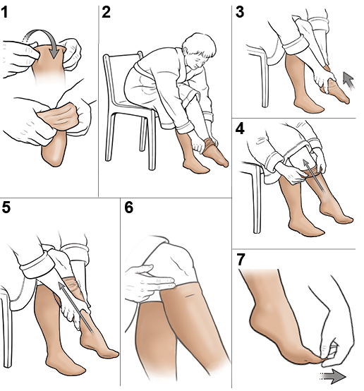 7 steps in putting on knee-high compression stockings