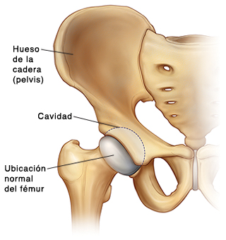 Vista frontal del hueso de la cadera (pelvis) que muestra cómo la cabeza del fémur encaja en la cavidad de la pelvis.