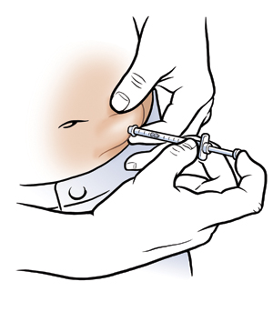 Primer plano de un abdomen en el que se ven manos que aplican una inyección subcutánea en el tejido graso del abdomen.