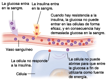Corte transversal de un vaso sanguíneo y una célula donde puede verse glucosa que se acumula en el torrente sanguíneo debido a la resistencia a la insulina.
