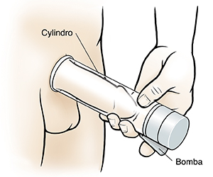 Primer plano del genital masculino con la bomba de vacío en el pene que se coloca con la mano.