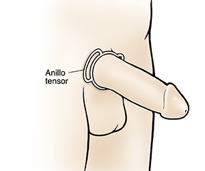 Primer plano del genital masculino con anillo tensor en la base del pene erecto.