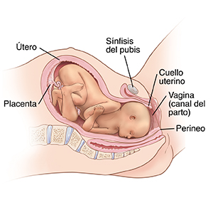 Vista lateral de la sección transversal de la pelvis de una mujer durante el parto en la que puede verse al bebé casi a través del canal de parto.