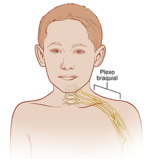 Vista frontal de la cabeza y los hombros de un niño que muestra el plexo braquial.